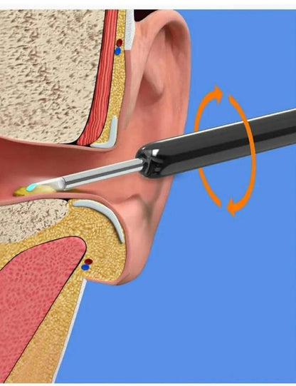 كاميرا الأذن اللاسلكي تنظيف آمن وفعال للأذن